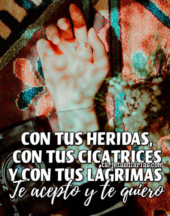 CON TUS HERIDAS, CON TUS CICATRICES Y CON TUS LÁGRIMAS, TE ACEPTO Y TE QUIERO